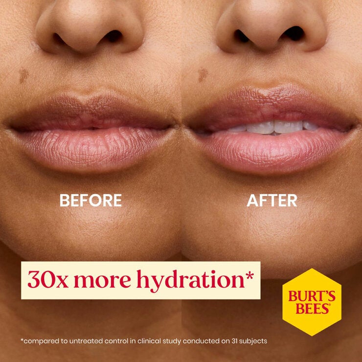 Before and After Before and After