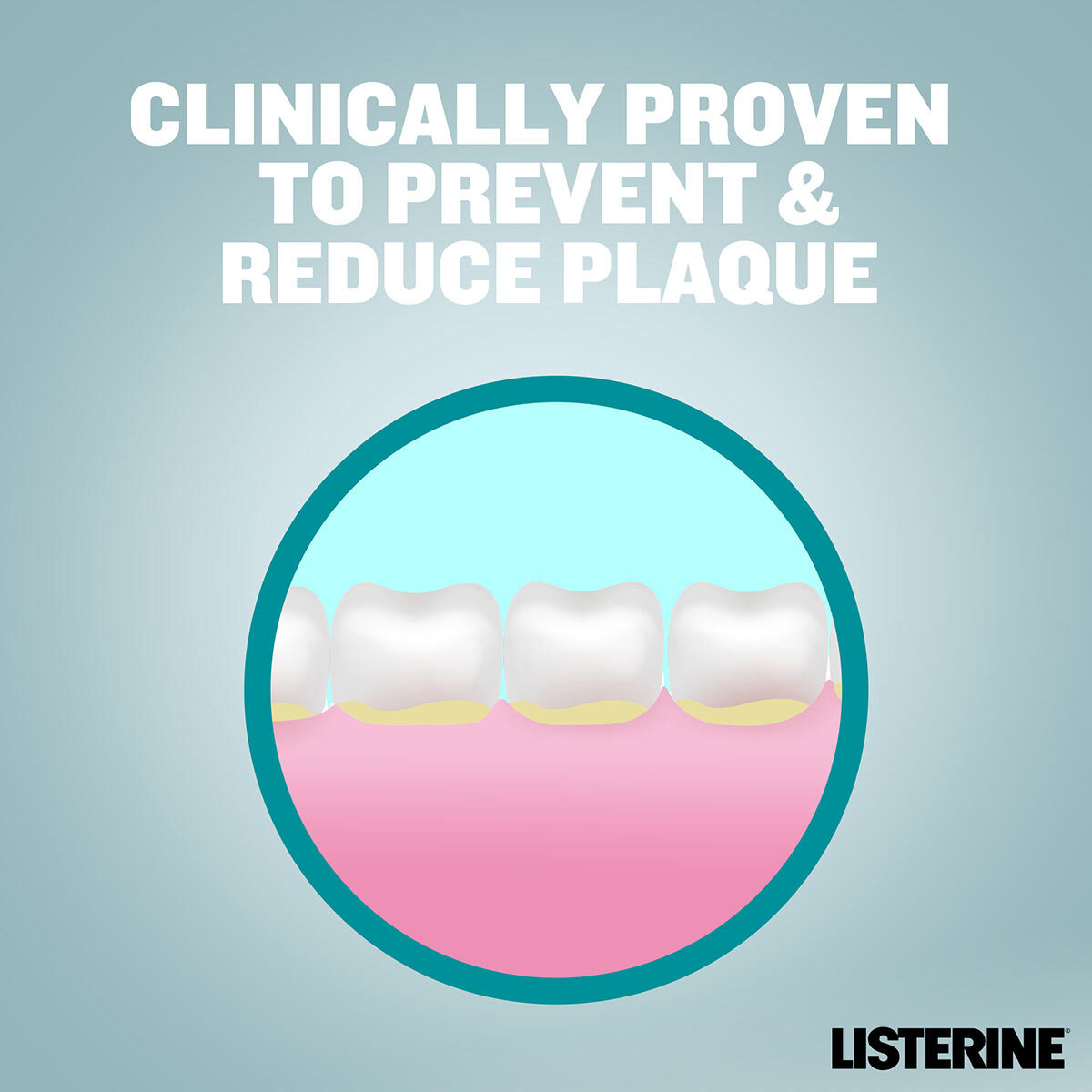 Prevent and Reduce Plaque