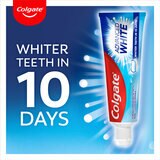 Whiter Teeth in 10 Days