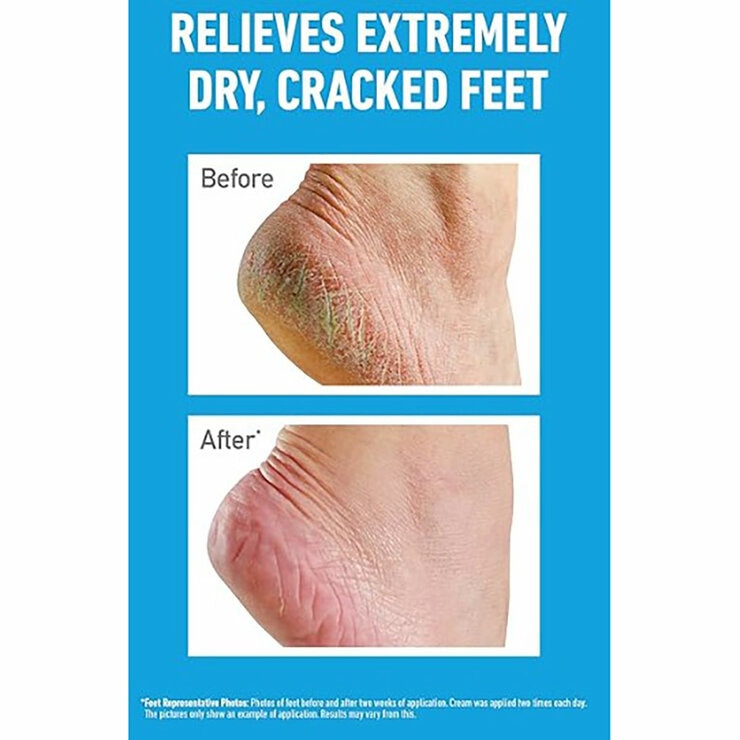 O'Keeffe's Healthy Feet Original, 2 x 180ml O'Keeffe's Healthy Feet Original, 2 x 180ml