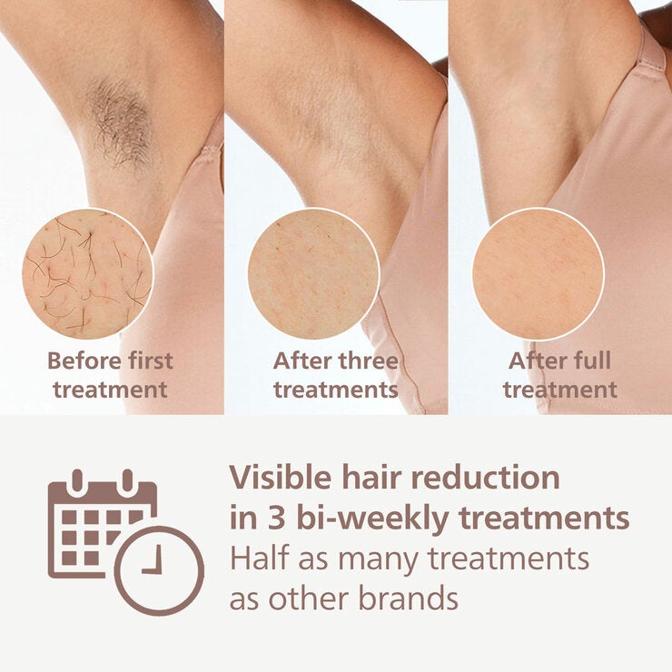 Lifestyle image of model using ipl Lifestyle image of model using ipl