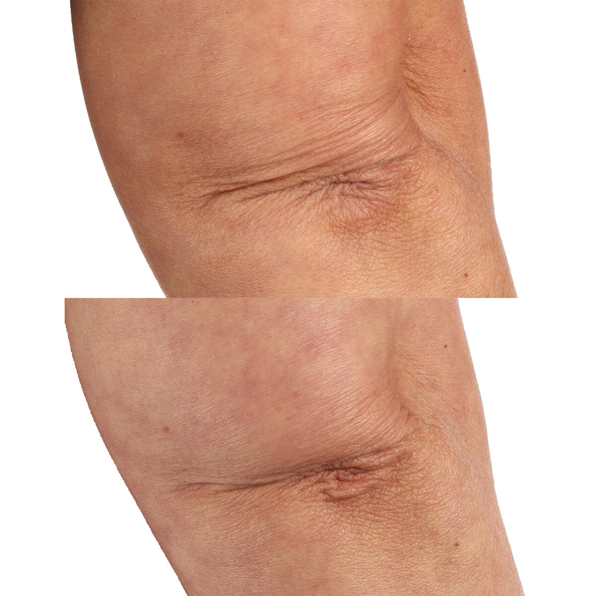 image of body oil on skin