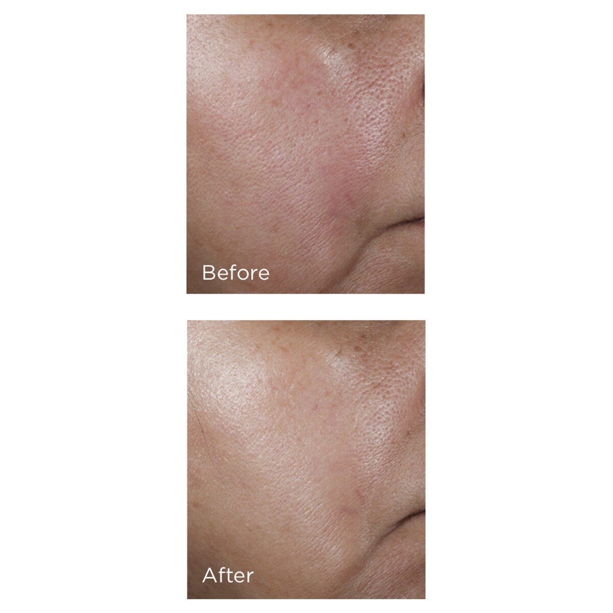 image of No Rinse Intensive Pore Minimising Toner