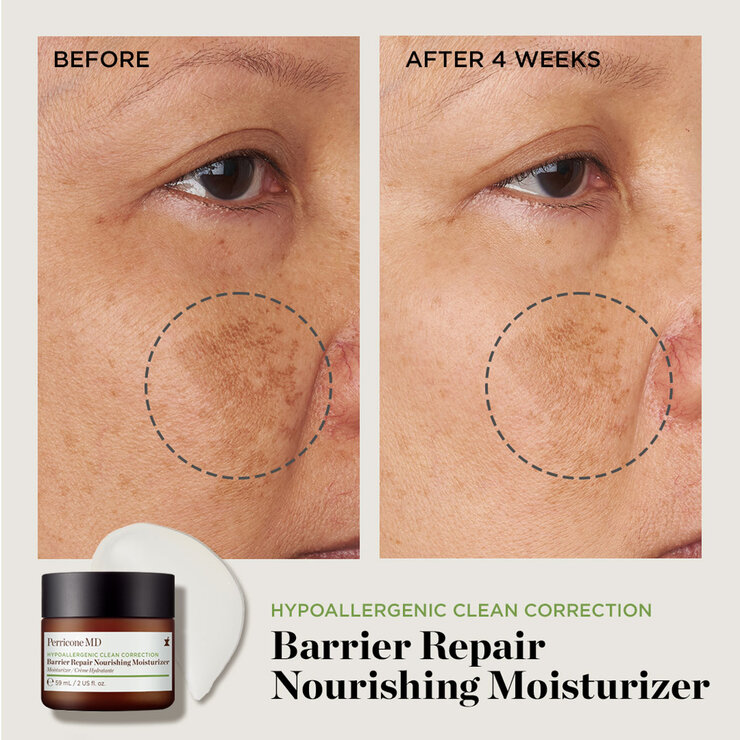 Perricone MD, Hypoallergenic Clean Correction, Barrier Repair Nourishing Moisturiser, 59ML