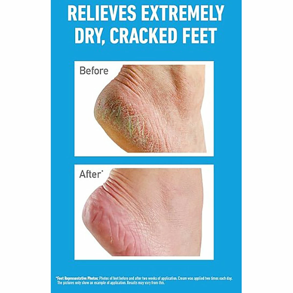 O'Keeffe's Healthy Feet Original, 2 x 180ml O'Keeffe's Healthy Feet Original, 2 x 180ml