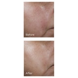 image of No Rinse Intensive Pore Minimising Toner